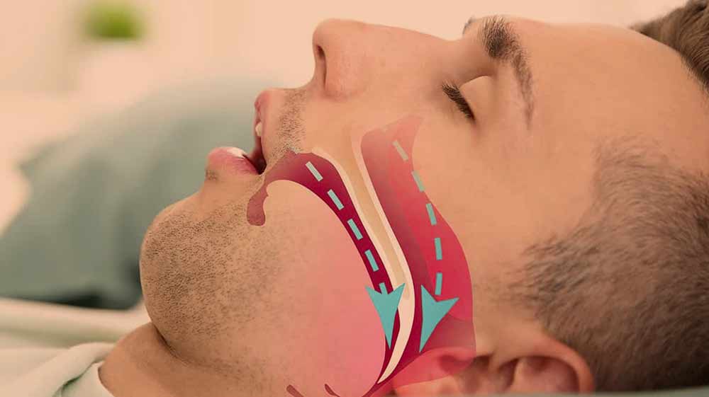 snoring-pharmacy-online